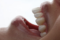Precision Dental Studio - Dentista Salvador - BA in Salvador