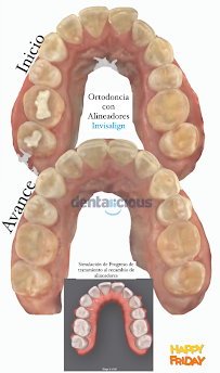 Ortodoncia Invisible | Dentalicious