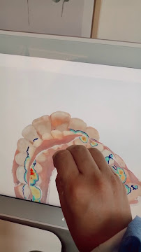 Ortodoncia Invisible | Dentalicious