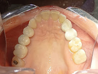 MOPE - URGÊNCIA ODONTOLÓGICA EM SALVADOR