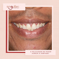 Singullari