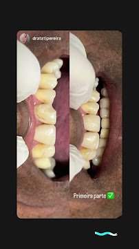 Clínica Sorrizués - Dentistas em Pernambués