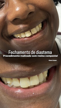 Clínica Sorrizués - Dentistas em Pernambués