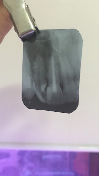 Urgency and Emergency 24 Hour Dentist