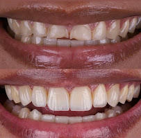 Urgency and Emergency 24 Hour Dentist