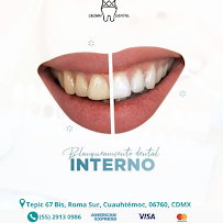 Crown Dental