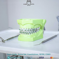Crown Dental
