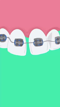 Crown Dental