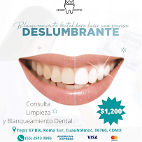 Crown Dental