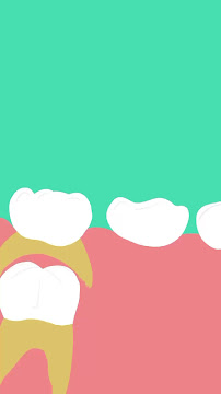 Crown Dental