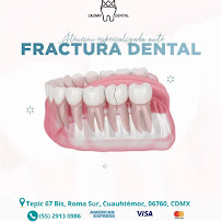 Crown Dental