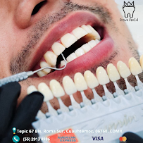 Crown Dental