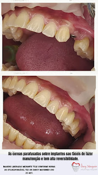 Dr Darcy Mavignier Odonto24h