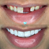 Dentista em Fortaleza - CE | Clínica Odontológica | Exclusiva Odontologia | Implante Dentário