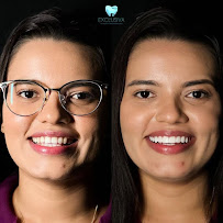 Dentista em Fortaleza - CE | Clínica Odontológica | Exclusiva Odontologia | Implante Dentário