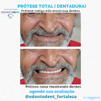 OdontoDent