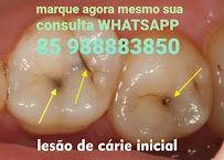 OdontoDent