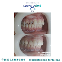OdontoDent