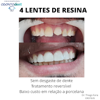 OdontoDent