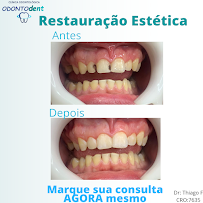 OdontoDent