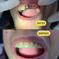 Implant Class