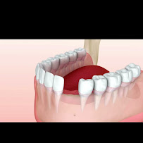 Implant Class