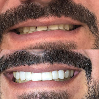 Dr. Paulo Camurça. Tratamento de Canal , Implante e Prótese. Dentista Fortaleza José Walter