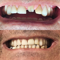 Dr. Paulo Camurça. Tratamento de Canal , Implante e Prótese. Dentista Fortaleza José Walter