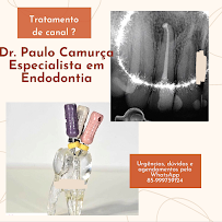 Dr. Paulo Camurça. Tratamento de Canal , Implante e Prótese. Dentista Fortaleza José Walter