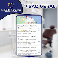 Dr. Paulo Camurça. Tratamento de Canal , Implante e Prótese. Dentista Fortaleza José Walter