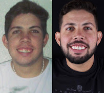 Dr. João Wirlon | Clínica Odontológica em Fortaleza | Complexo Odontológico Implantar
