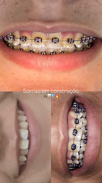 Odonto Mil