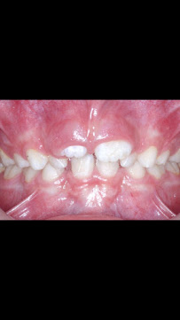 Dentista SmileMed - Clínica Dental