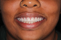 PROCLINIC ESPECIALIDADES DENTALES