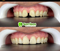 Dentista no Conjunto Ceará | Clínica Mais Sorrisos