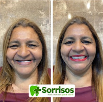 Dentista no Conjunto Ceará | Clínica Mais Sorrisos