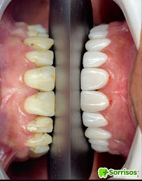 Dentista no Conjunto Ceará | Clínica Mais Sorrisos