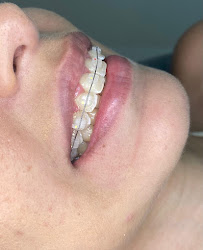 Dentista no Conjunto Ceará | Clínica Mais Sorrisos
