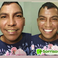 Dentista no Conjunto Ceará | Clínica Mais Sorrisos