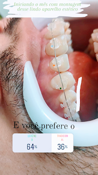 Dentista no Conjunto Ceará | Clínica Mais Sorrisos