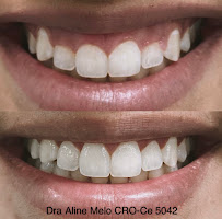 Dr Aline Melo Periodontia Salinas/Montese