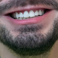 Dr Aline Melo Periodontia Salinas/Montese