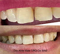 Dr Aline Melo Periodontia Salinas/Montese