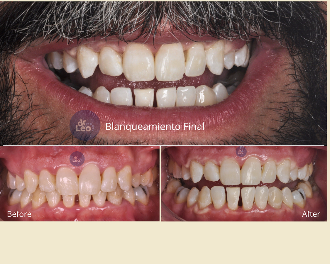 Dentall clinic in Guadalajara - dental clinic in Guadalajara