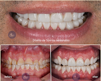 Dentall clinic in Guadalajara