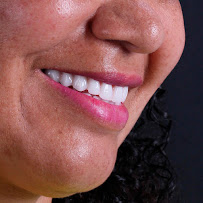 Implante Dentário | Santé Clínica Odontológica | Dentista em Santo Agostinho - BH