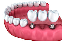 Dentistas Belo Horizonte