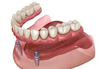 Dentistas Belo Horizonte
