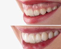 Dentistas Belo Horizonte