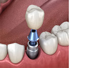 Dentistas Belo Horizonte